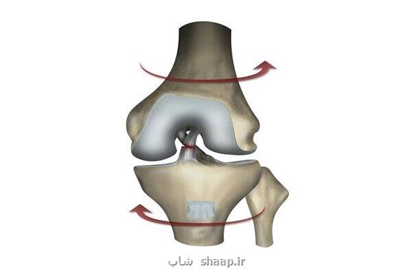 جراحی رباط صلیبی با پرده جفت جنین